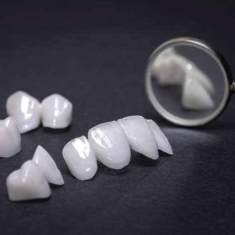 Metal-free restorations on black background next to a dental mirror