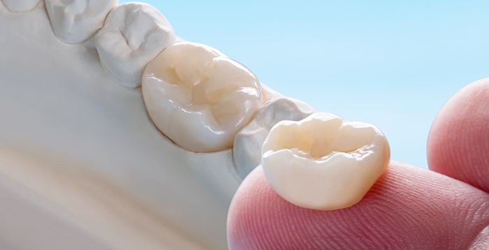 Close-up of dental crowns in Greenwood Village, one on model of teeth and one on finger