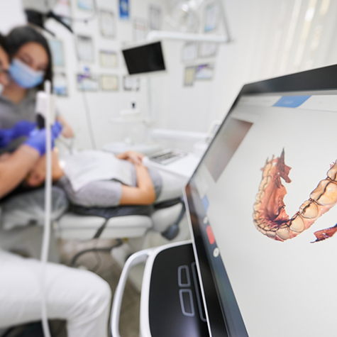 Digital impression on screen with dentist scanning patient's teeth in background