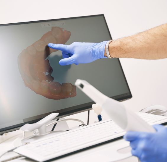 Dentist holding intraoral camera pointing to scan of teeth on monitor