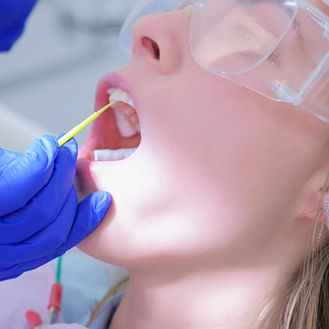 Female patient receiving fluoride treatment on upper teeth