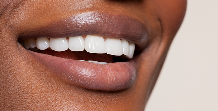 Close-up of a woman's smile